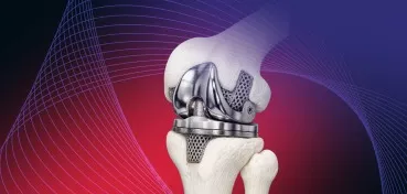 Современные 3D-технологии для производителей медоборудования: вебинар с разбором примеров