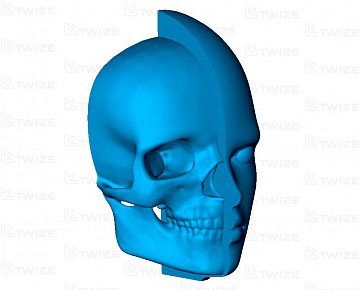 3D‑прототип головы из гипсового композита  - вид 3