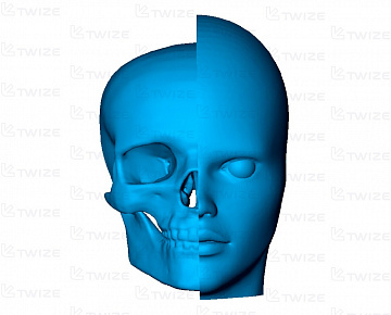 3D‑прототип головы из гипсового композита  - вид 1